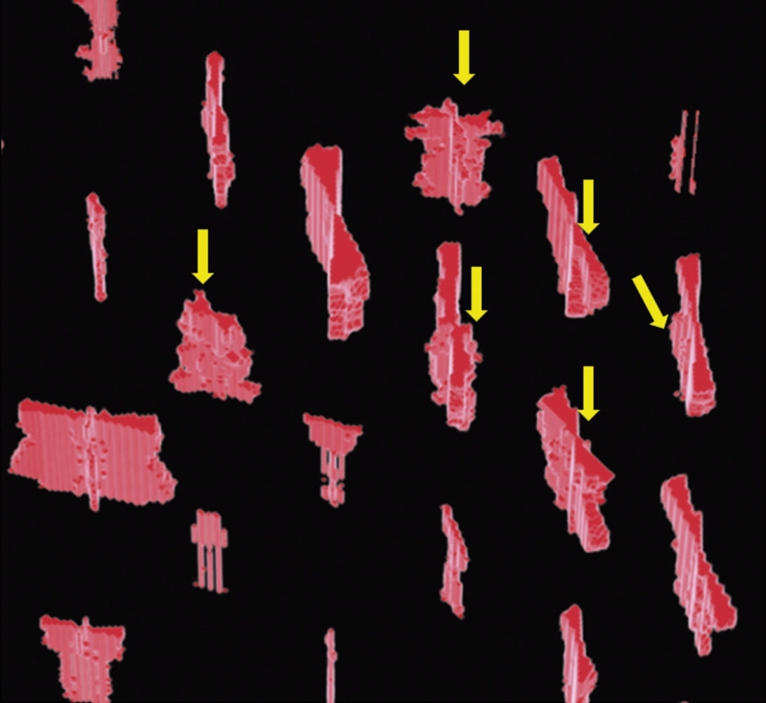Fig. 13