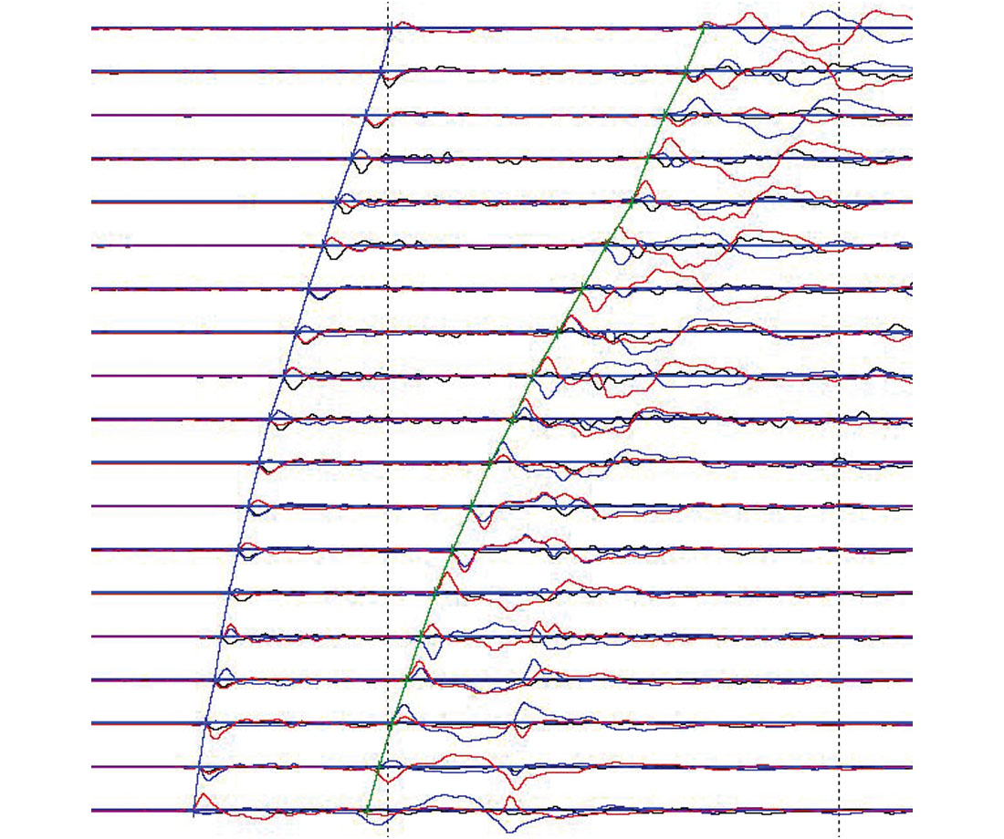 Fig. 04