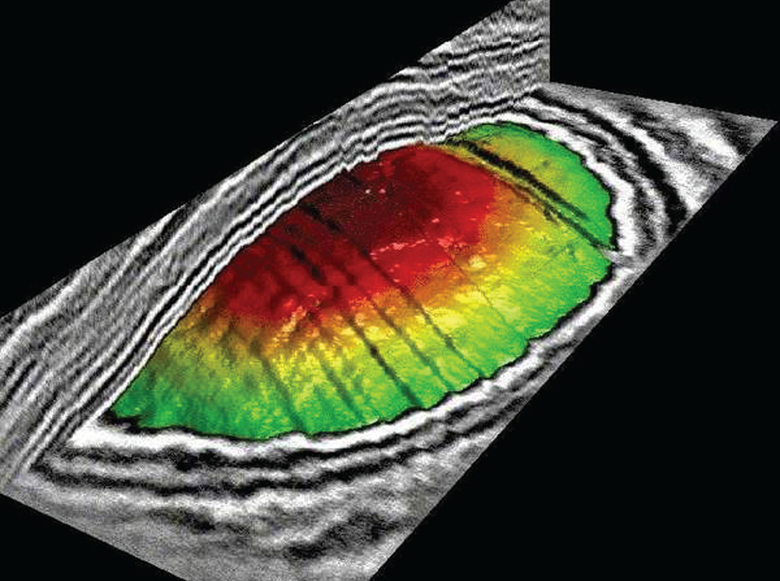 Fig. 03