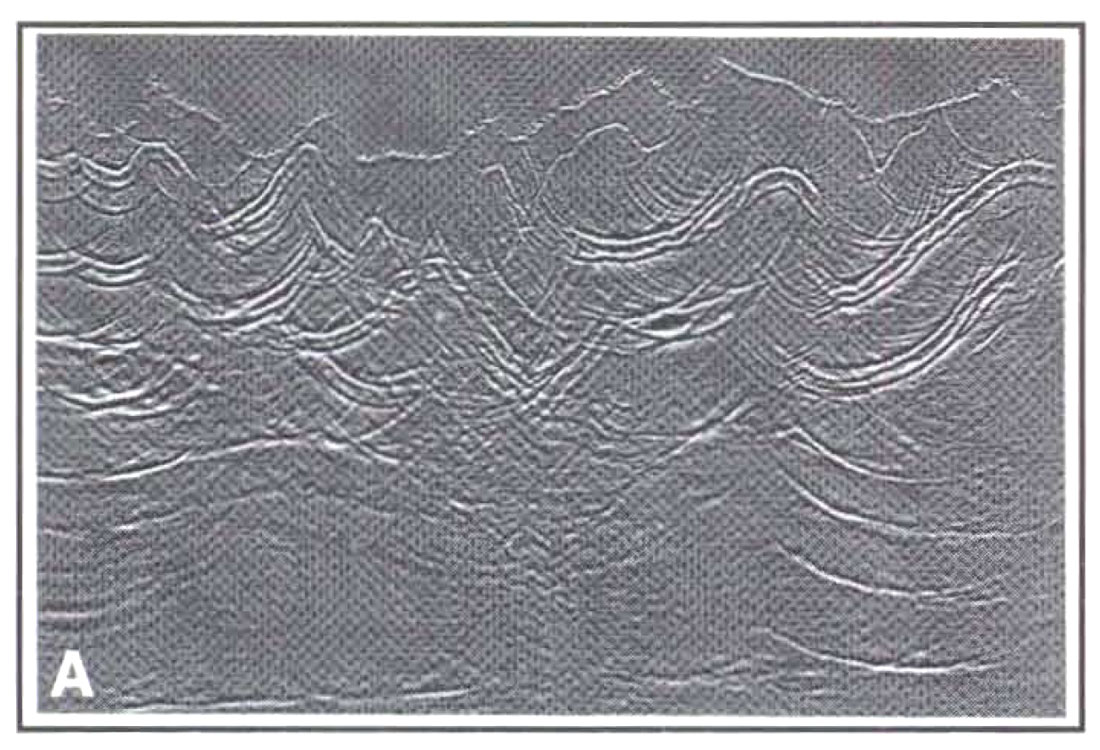 Fig. 01a