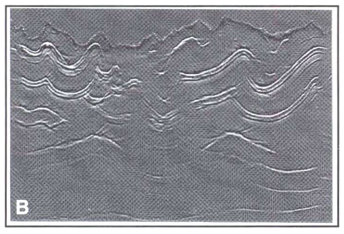 Fig. 01b