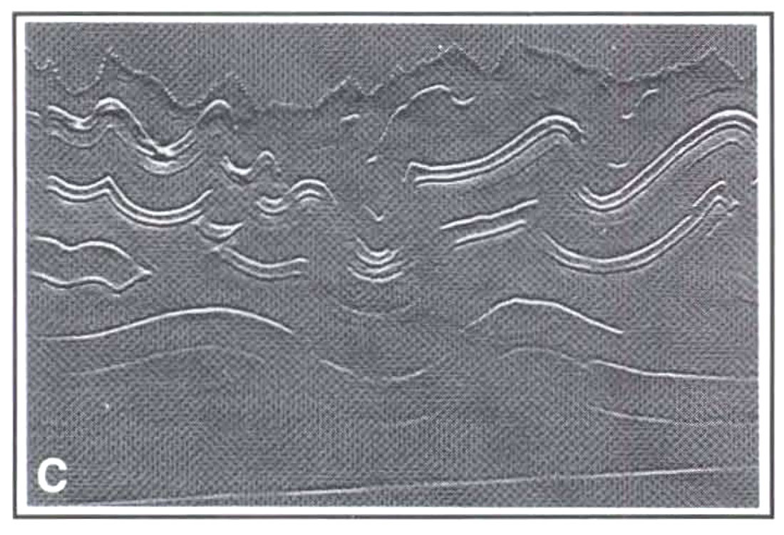Fig. 01c