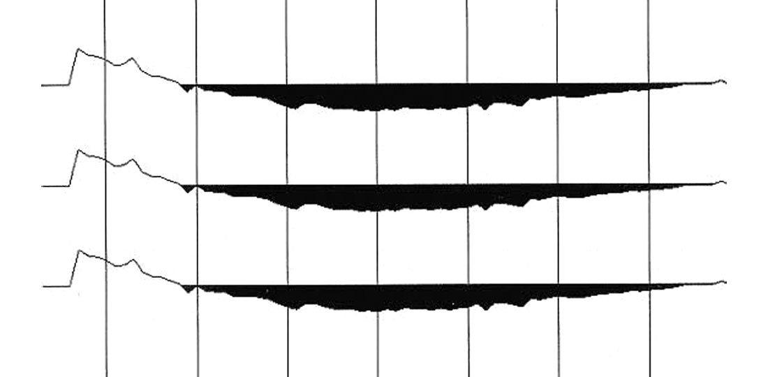 Fig. 02
