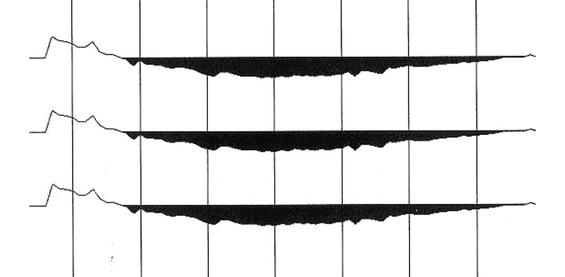Fig. 03