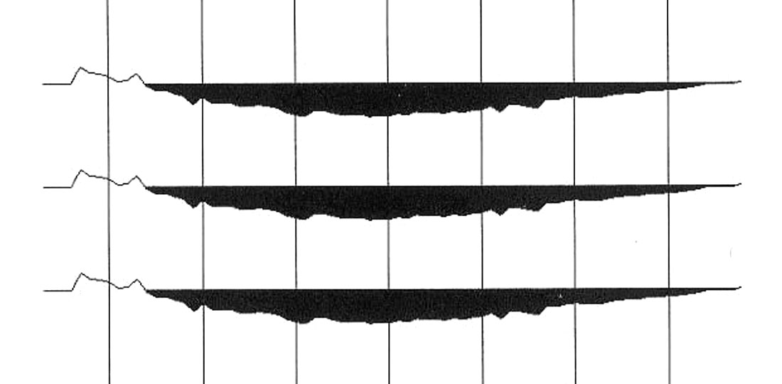 Fig. 04