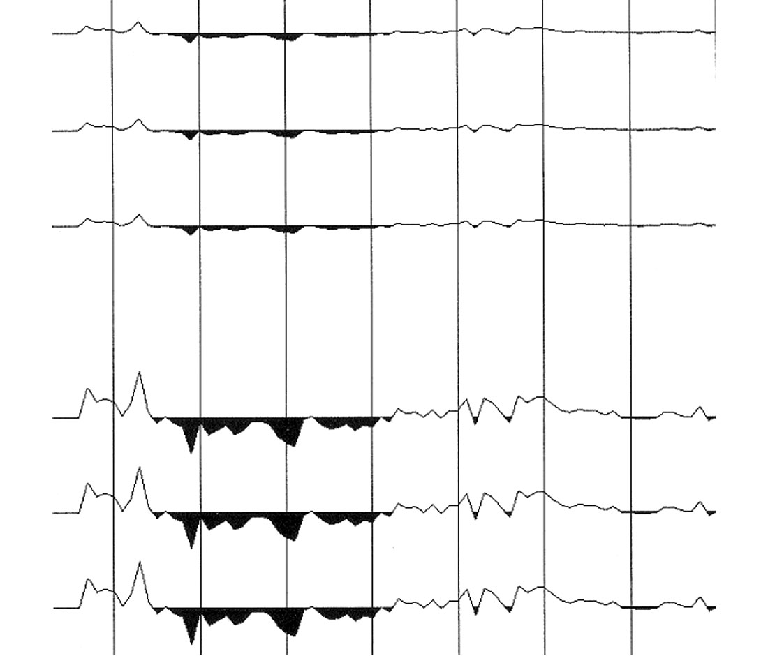 Fig. 05