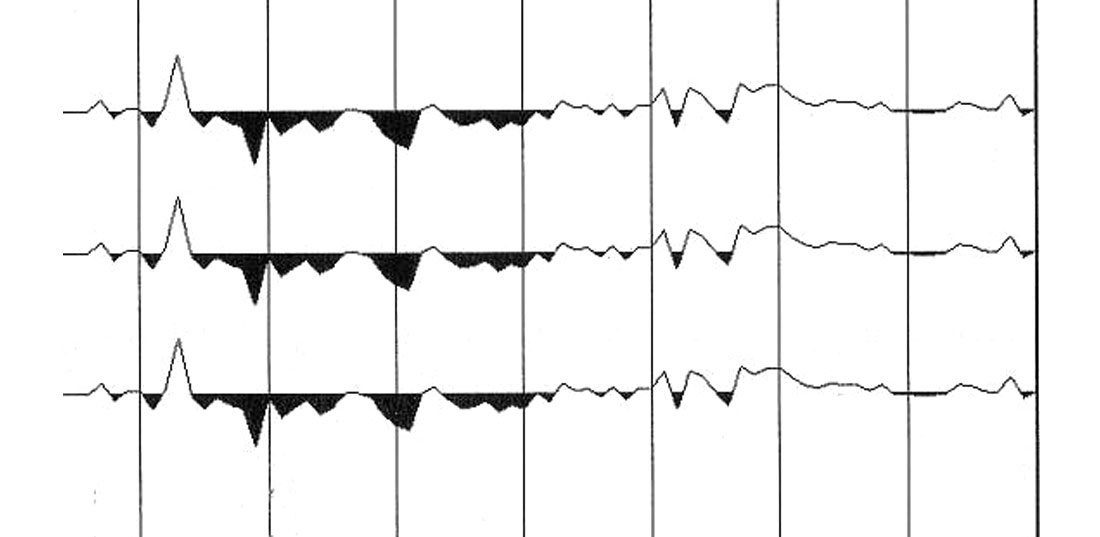 Fig. 06