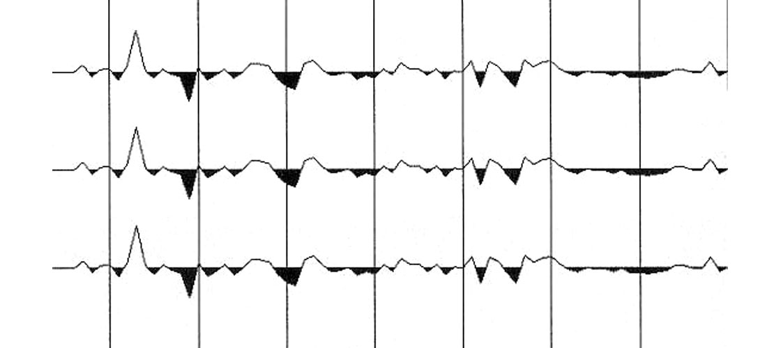 Fig. 08