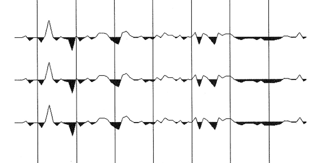 Fig. 10