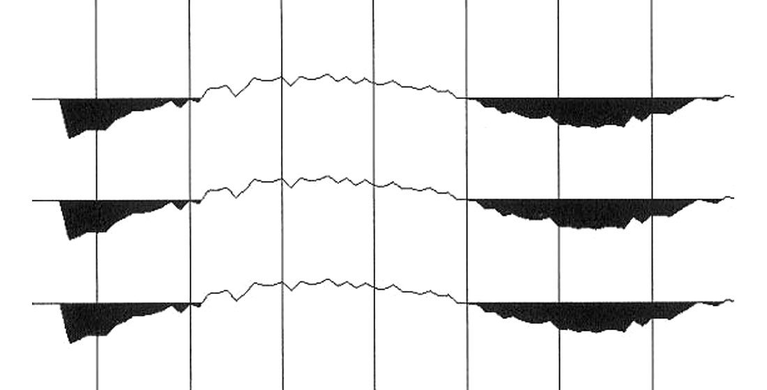 Fig. 11