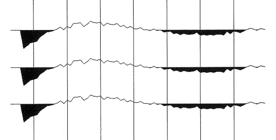 Fig. 12