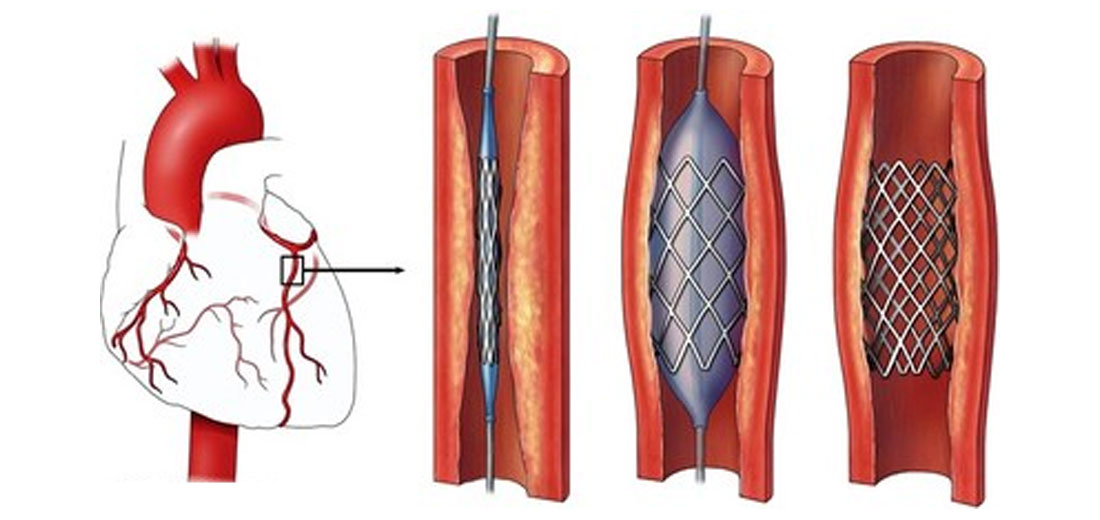 Fig. 03